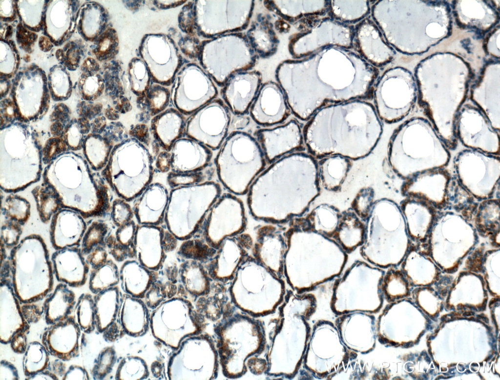 Immunohistochemistry (IHC) staining of human thyroid tissue using calreticulin Polyclonal antibody (10292-1-AP)