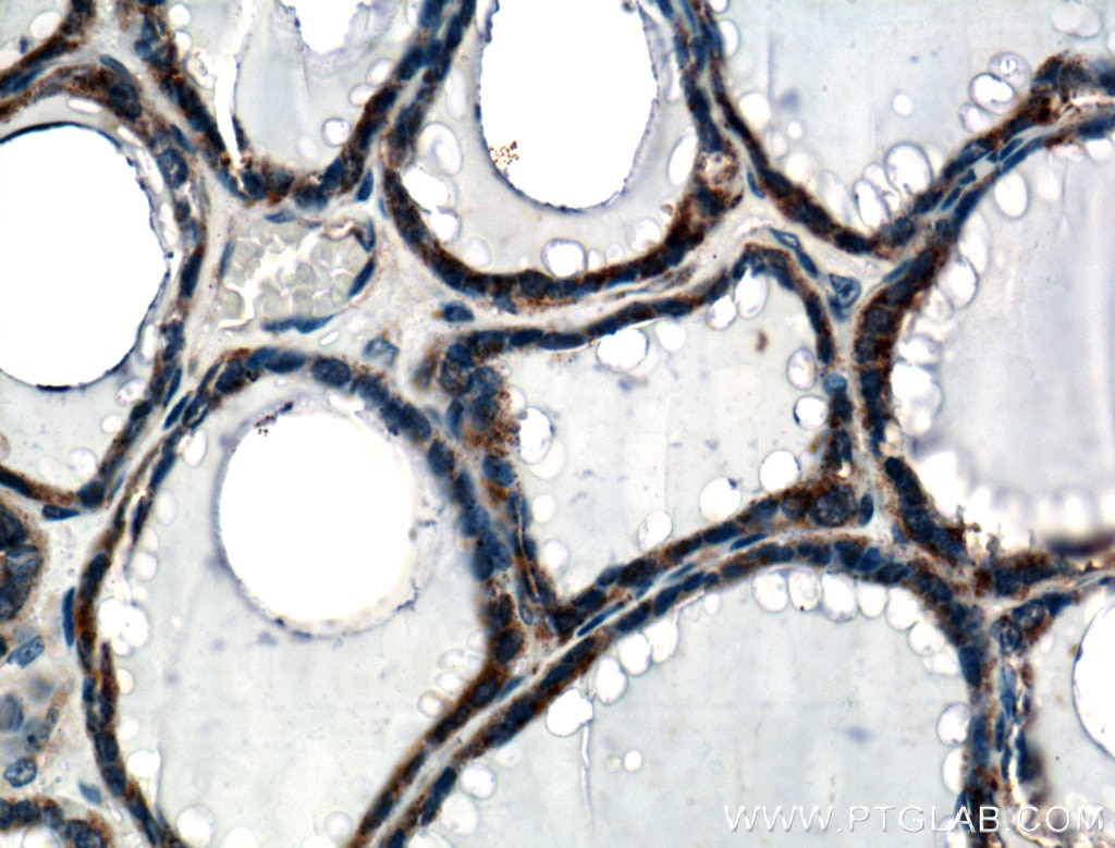 Immunohistochemistry (IHC) staining of human thyroid tissue using calreticulin Polyclonal antibody (10292-1-AP)