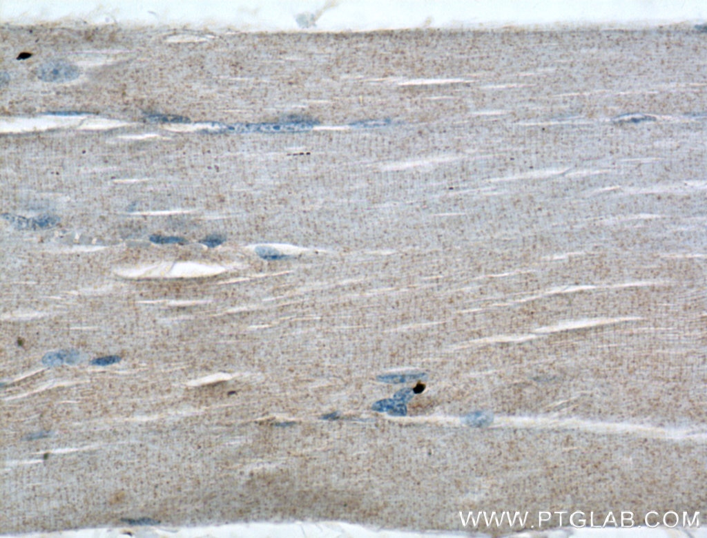 IHC staining of human skeletal muscle using 10292-1-AP