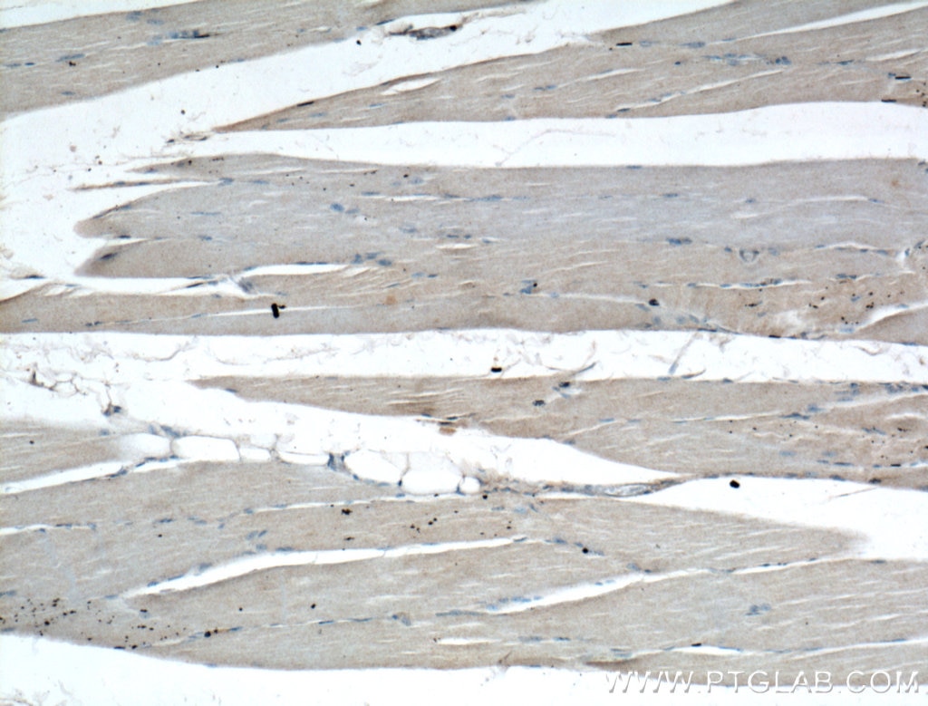 IHC staining of human skeletal muscle using 10292-1-AP