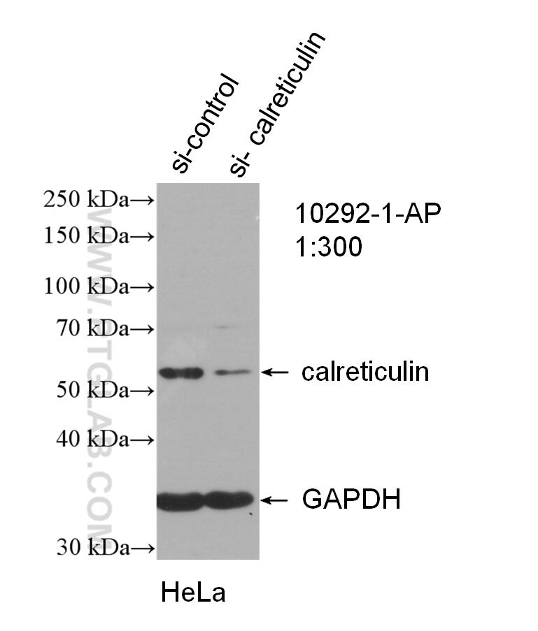 Western Blot (WB) analysis of HeLa cells using calreticulin Polyclonal antibody (10292-1-AP)