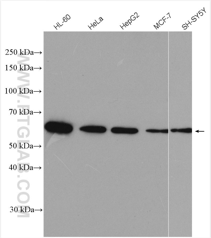 Western Blot (WB) analysis of various lysates using calreticulin Polyclonal antibody (10292-1-AP)