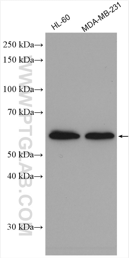 Western Blot (WB) analysis of various lysates using calreticulin Polyclonal antibody (10292-1-AP)