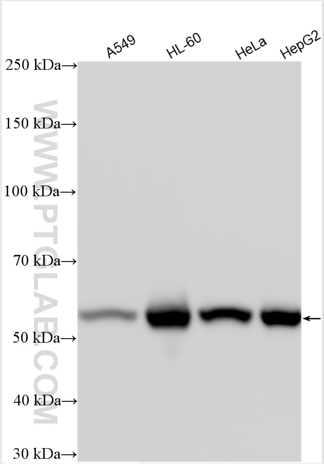 Western Blot (WB) analysis of various lysates using calreticulin Polyclonal antibody (10292-1-AP)