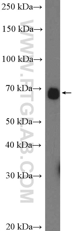 Western Blot (WB) analysis of rat brain tissue using calreticulin Polyclonal antibody (10292-1-AP)