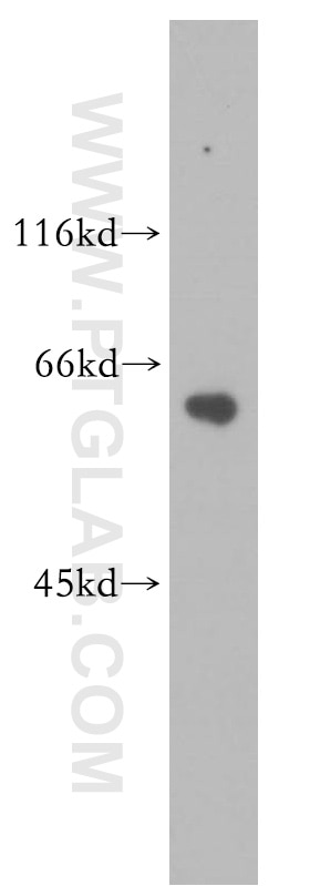 Western Blot (WB) analysis of human skeletal muscle tissue using calreticulin Polyclonal antibody (10292-1-AP)