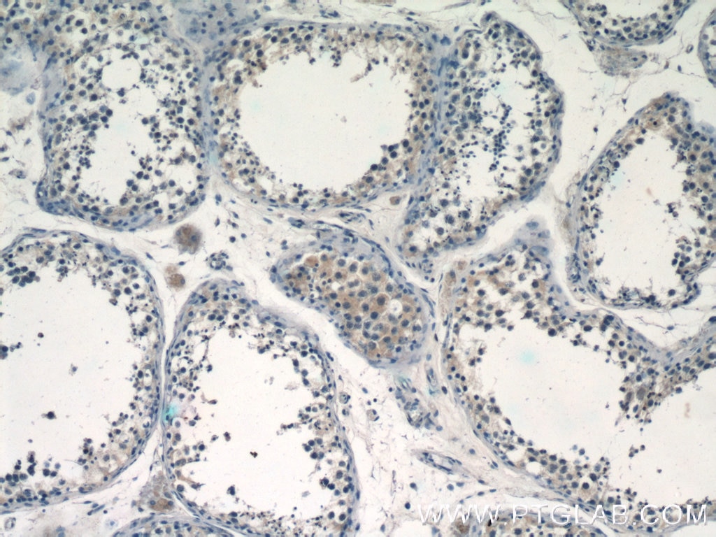 Immunohistochemistry (IHC) staining of human testis tissue using CALR3 Polyclonal antibody (17064-1-AP)