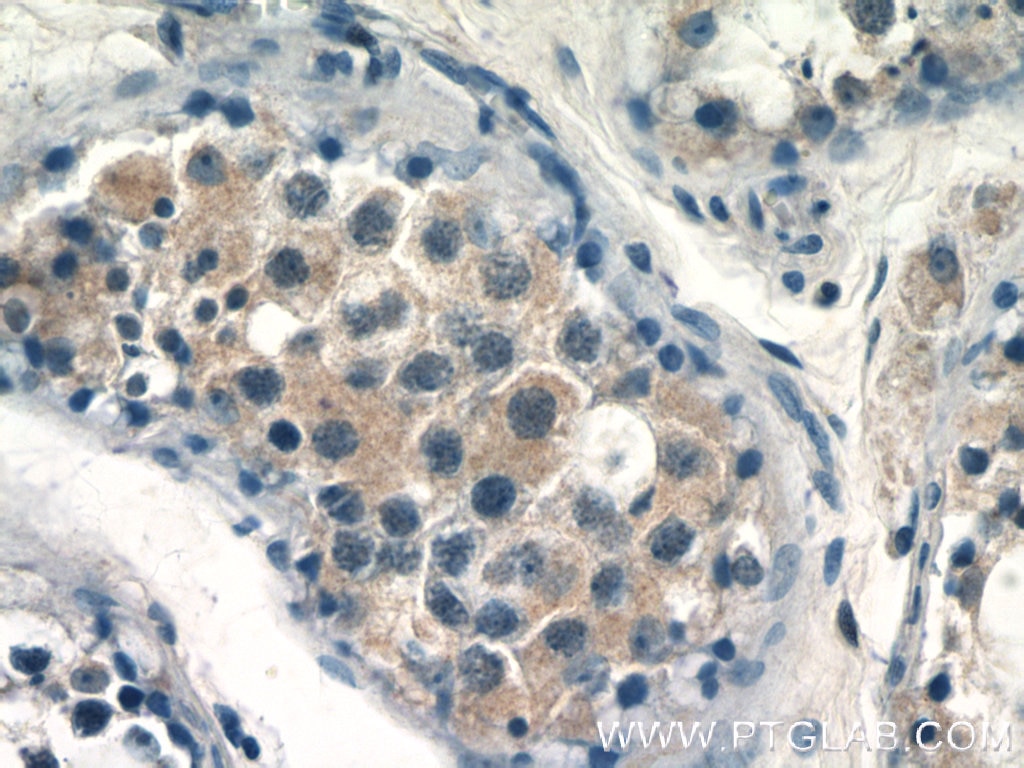 Immunohistochemistry (IHC) staining of human testis tissue using CALR3 Polyclonal antibody (17064-1-AP)
