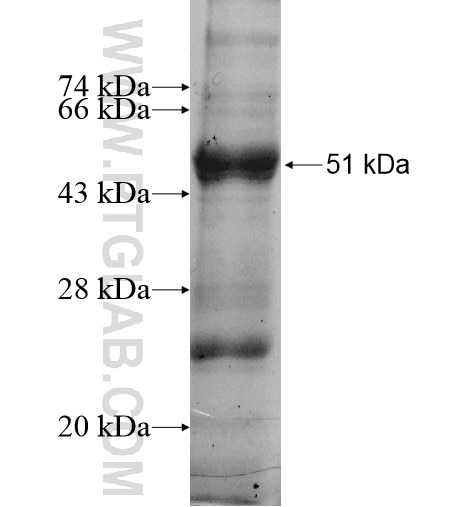CALR3 fusion protein Ag10847 SDS-PAGE