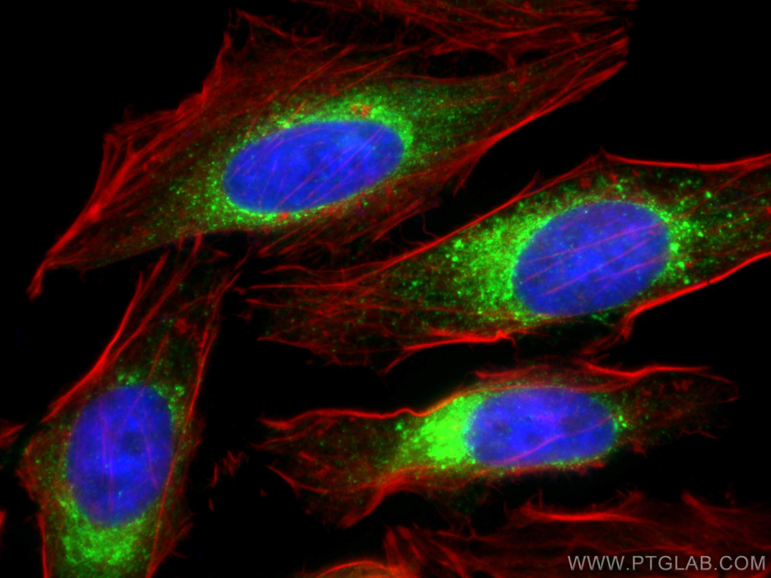 Immunofluorescence (IF) / fluorescent staining of HeLa cells using Calumenin Polyclonal antibody (17804-1-AP)
