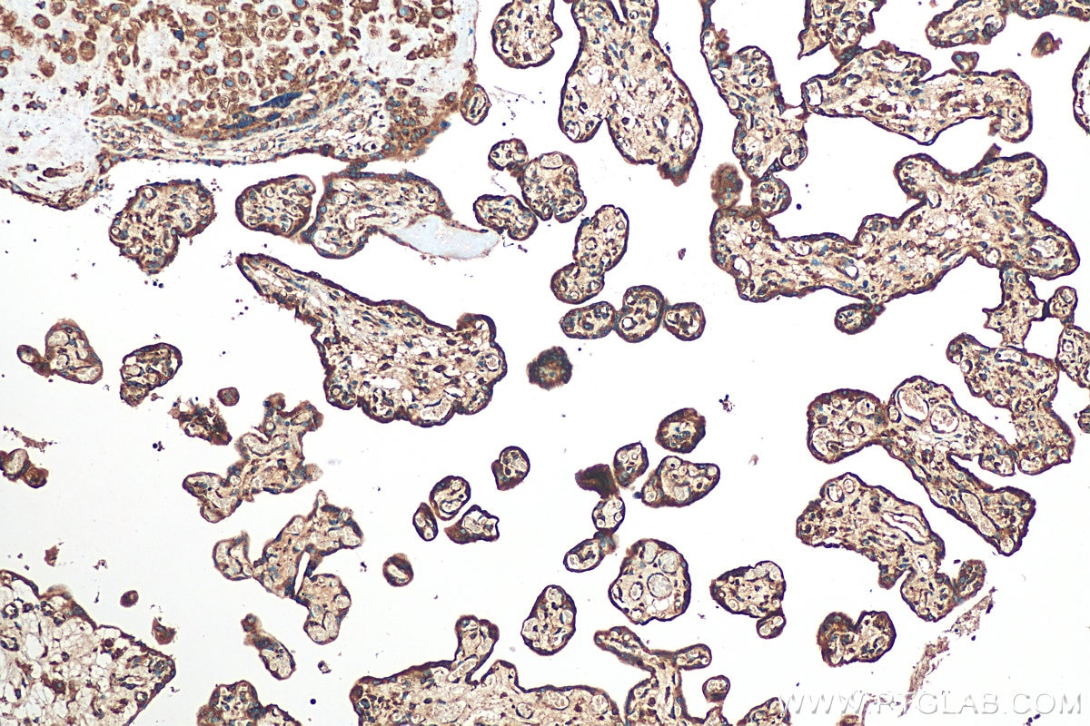Immunohistochemistry (IHC) staining of human placenta tissue using Calumenin Polyclonal antibody (17804-1-AP)