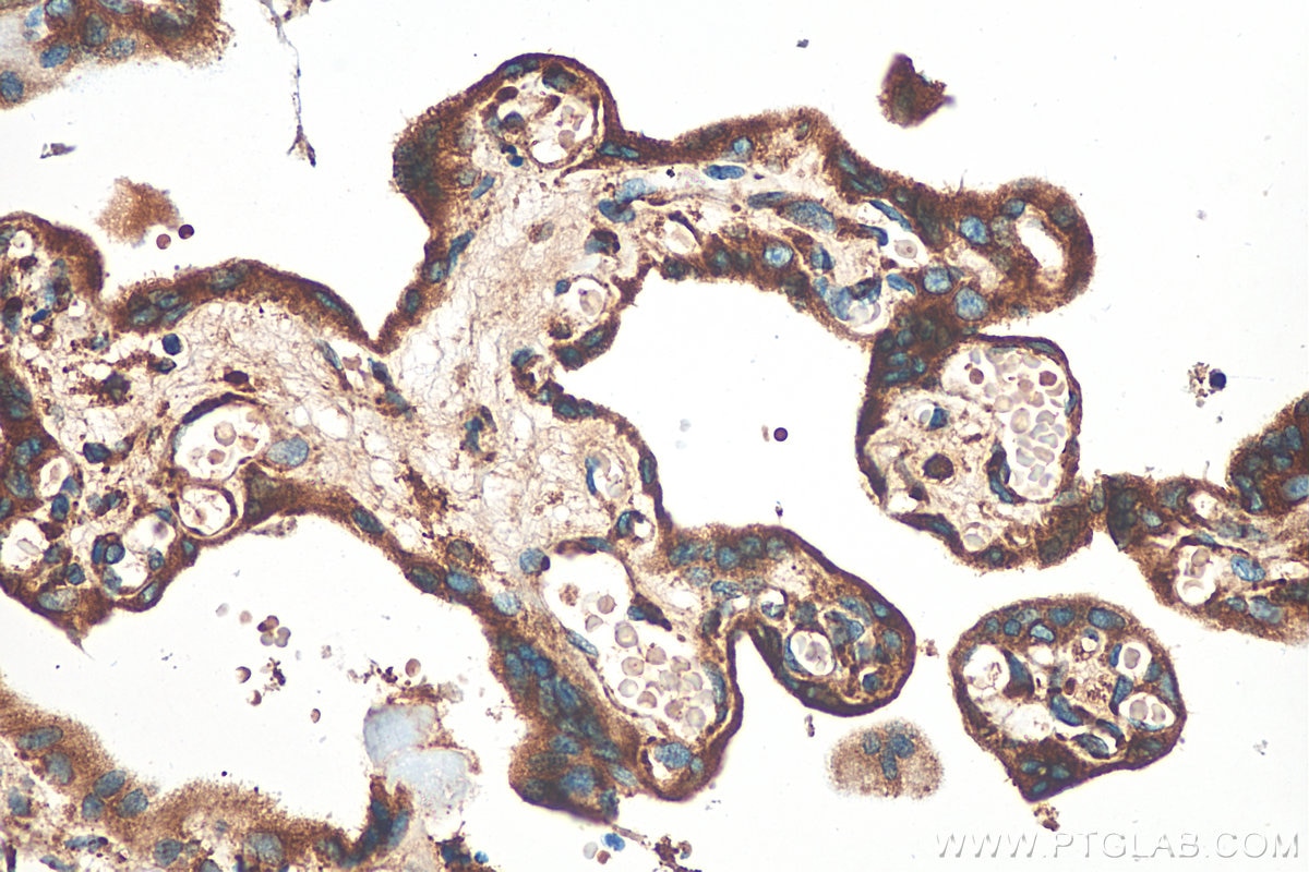 Immunohistochemistry (IHC) staining of human placenta tissue using Calumenin Polyclonal antibody (17804-1-AP)