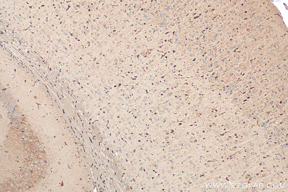 Immunohistochemistry (IHC) staining of mouse brain tissue using Calumenin Polyclonal antibody (17804-1-AP)