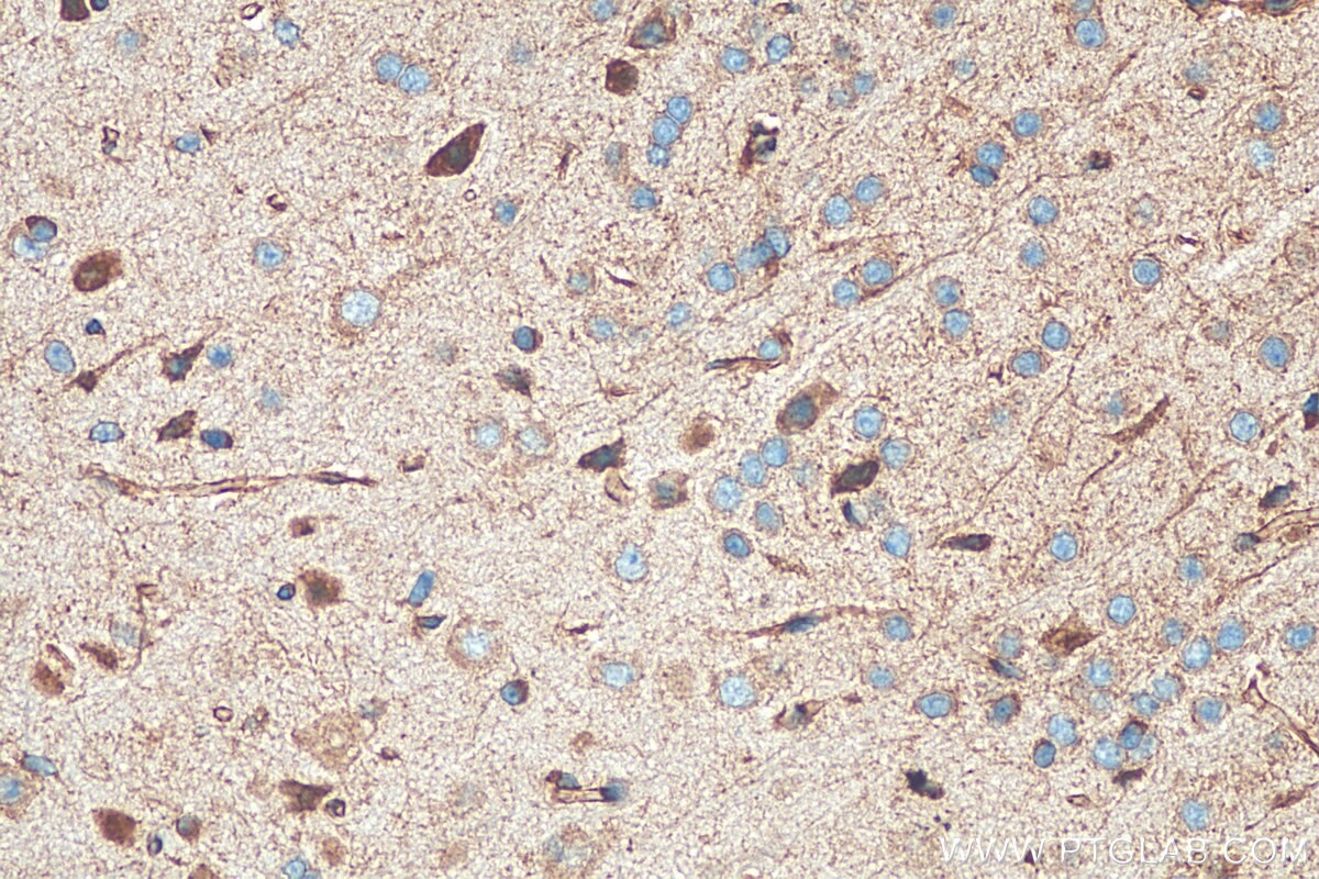 Immunohistochemistry (IHC) staining of mouse brain tissue using Calumenin Polyclonal antibody (17804-1-AP)