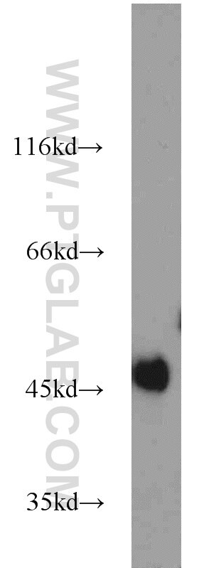 Western Blot (WB) analysis of mouse kidney tissue using Calumenin Polyclonal antibody (17804-1-AP)