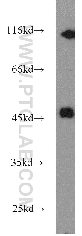 WB analysis of HepG2 using 17804-1-AP