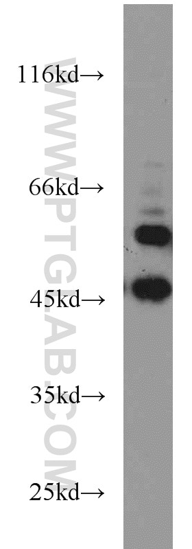 Western Blot (WB) analysis of HEK-293 cells using Calumenin Polyclonal antibody (17804-1-AP)