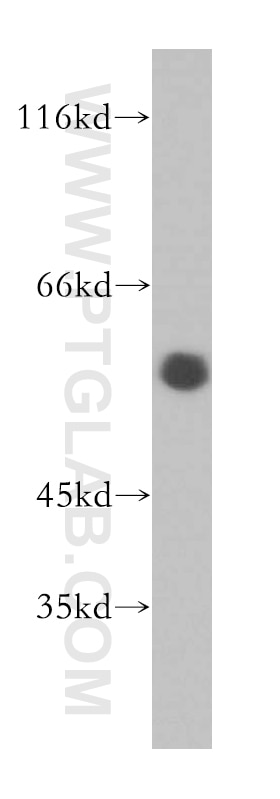 Western Blot (WB) analysis of human placenta tissue using Calumenin Polyclonal antibody (17804-1-AP)