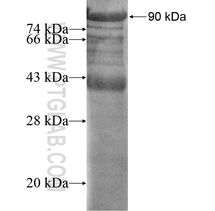 CALU fusion protein Ag12073 SDS-PAGE