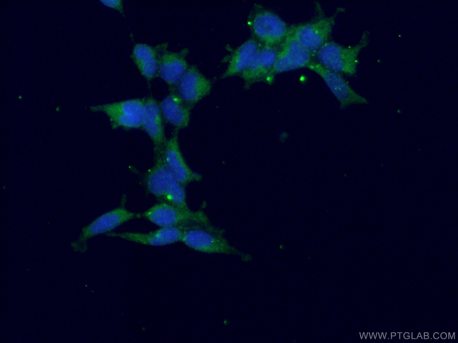 Immunofluorescence (IF) / fluorescent staining of HEK-293 cells using CAMK1 Polyclonal antibody (24312-1-AP)