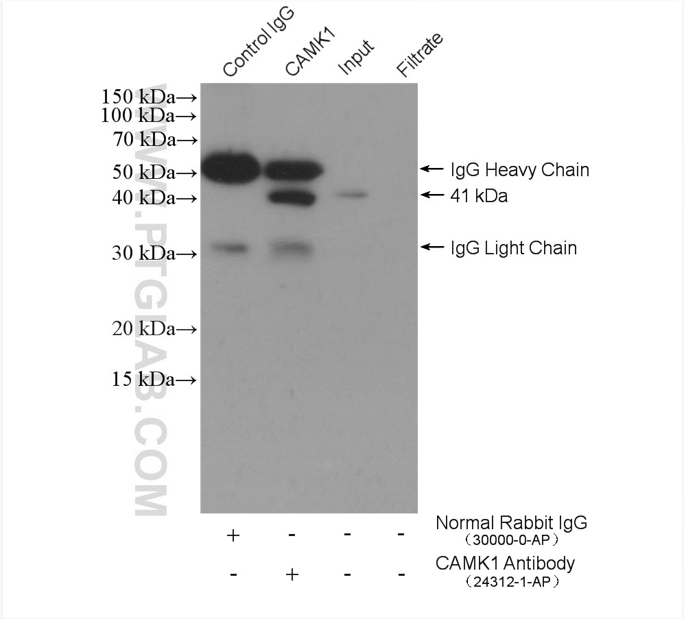Immunoprecipitation (IP) experiment of HEK-293 cells using CAMK1 Polyclonal antibody (24312-1-AP)