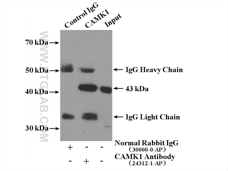 Immunoprecipitation (IP) experiment of HEK-293 cells using CAMK1 Polyclonal antibody (24312-1-AP)