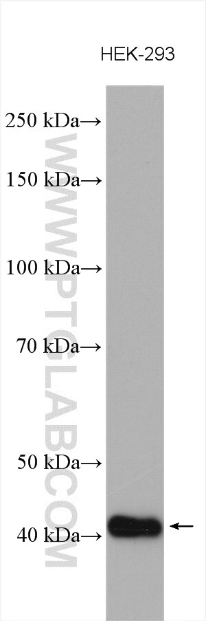 Western Blot (WB) analysis of various lysates using CAMK1 Polyclonal antibody (24312-1-AP)