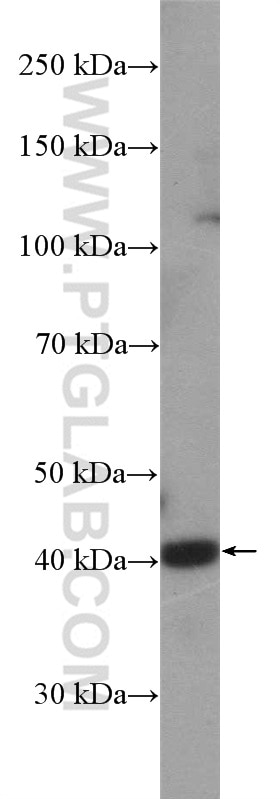 Western Blot (WB) analysis of HEK-293 cells using CAMK1 Polyclonal antibody (24312-1-AP)