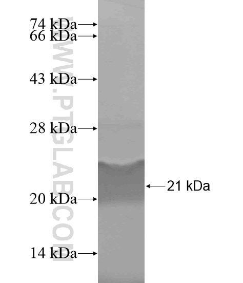 CAMK1 fusion protein Ag19473 SDS-PAGE