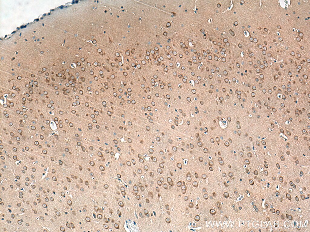 Immunohistochemistry (IHC) staining of mouse brain tissue using CAMK1D Polyclonal antibody (13613-1-AP)