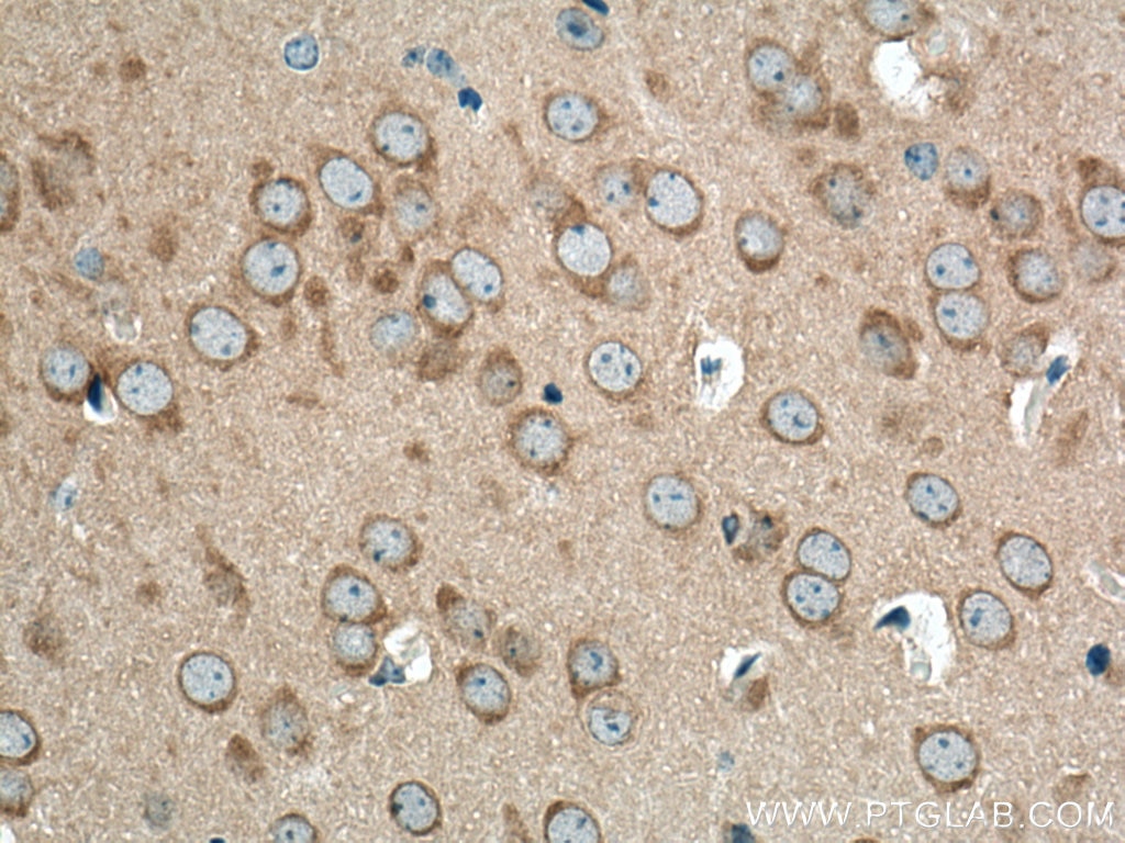 Immunohistochemistry (IHC) staining of mouse brain tissue using CAMK1D Polyclonal antibody (13613-1-AP)