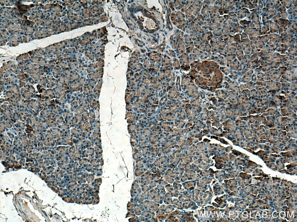 Immunohistochemistry (IHC) staining of human pancreas tissue using CAMK1D Polyclonal antibody (13613-1-AP)