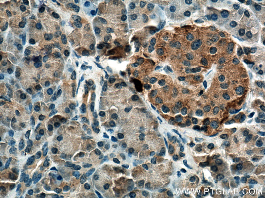 Immunohistochemistry (IHC) staining of human pancreas tissue using CAMK1D Polyclonal antibody (13613-1-AP)