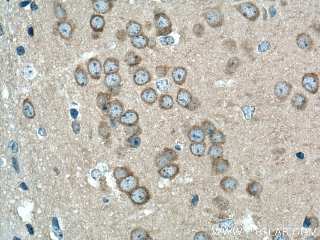 Immunohistochemistry (IHC) staining of mouse brain tissue using CAMK1D Polyclonal antibody (13613-1-AP)