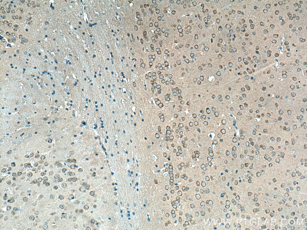 Immunohistochemistry (IHC) staining of mouse brain tissue using CAMK1D Polyclonal antibody (13613-1-AP)