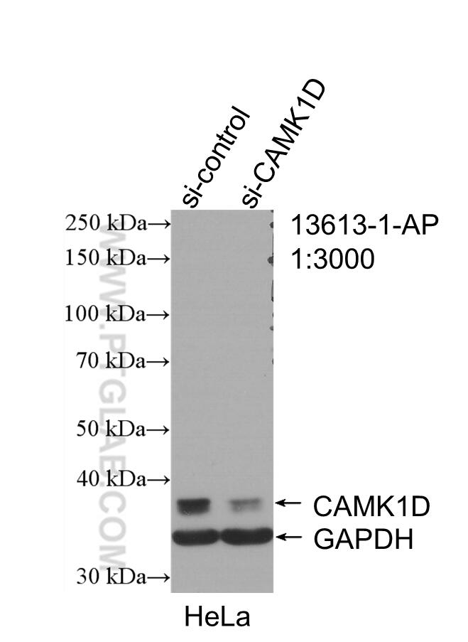 Western Blot (WB) analysis of HeLa cells using CAMK1D Polyclonal antibody (13613-1-AP)