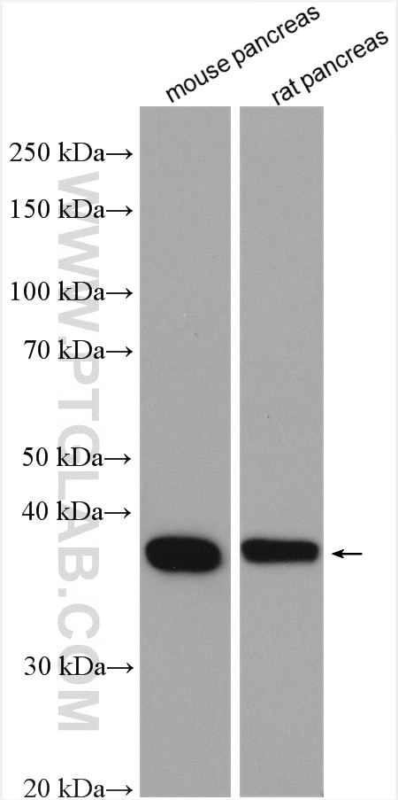 Western Blot (WB) analysis of various lysates using CAMK1D Polyclonal antibody (13613-1-AP)