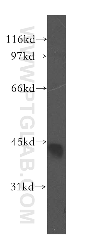 Western Blot (WB) analysis of mouse pancreas tissue using CAMK1D Polyclonal antibody (13613-1-AP)