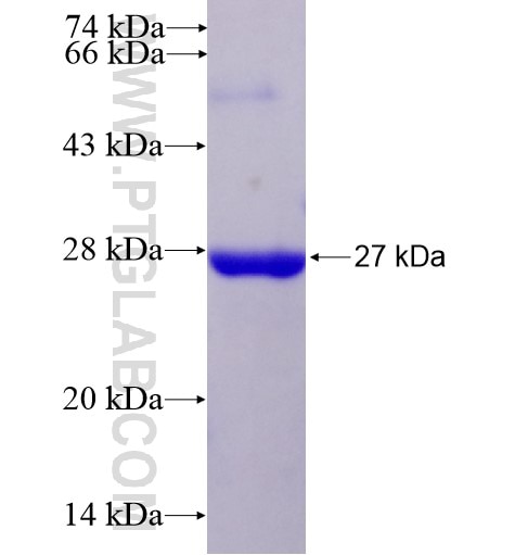 CAMK1D fusion protein Ag4709 SDS-PAGE