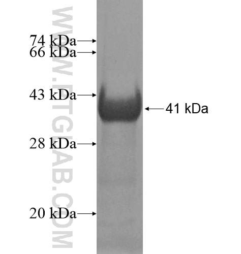 CAMK1G fusion protein Ag11467 SDS-PAGE