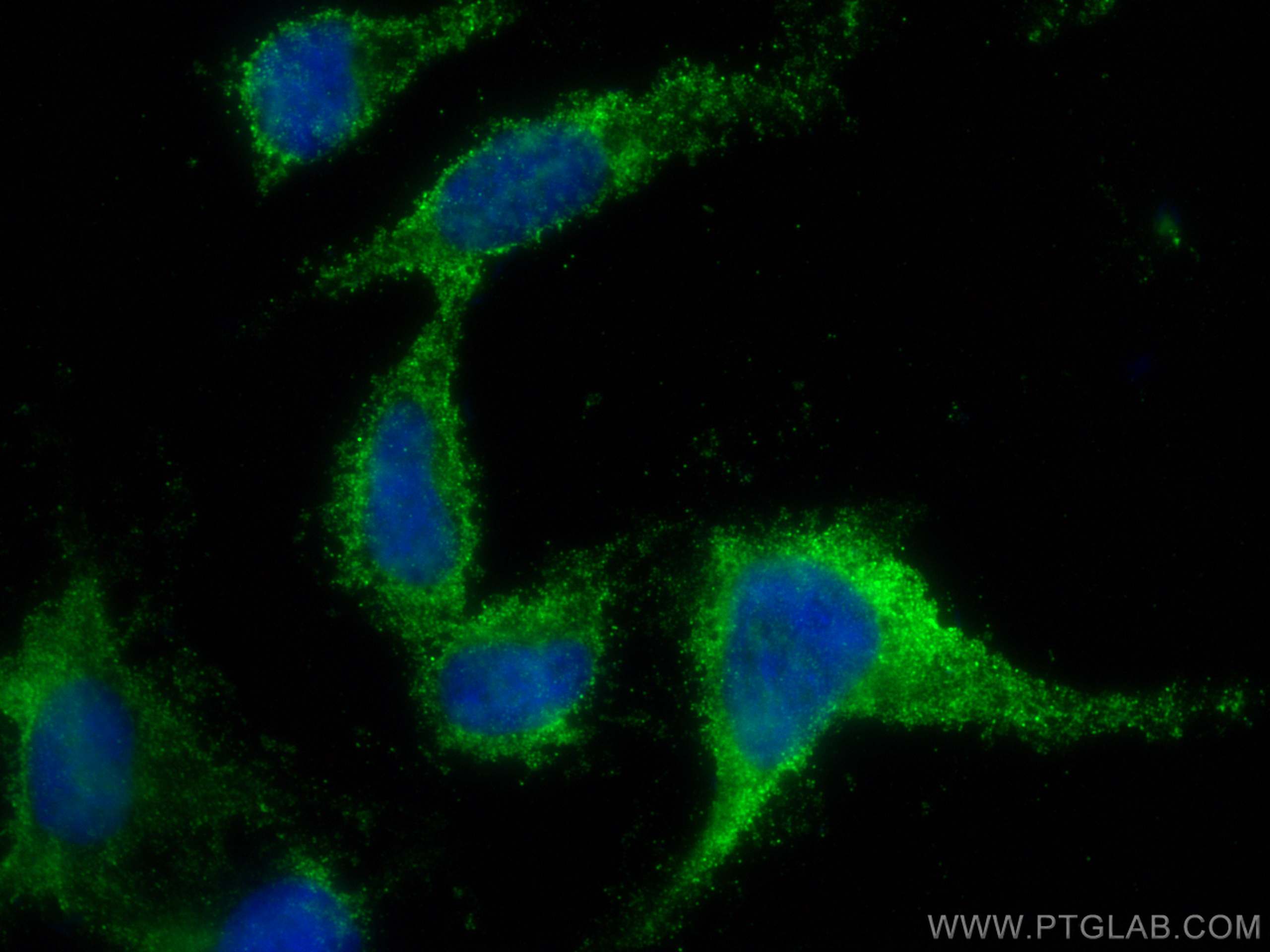 Immunofluorescence (IF) / fluorescent staining of SH-SY5Y cells using CaMKII alpha Monoclonal antibody (66843-1-Ig)