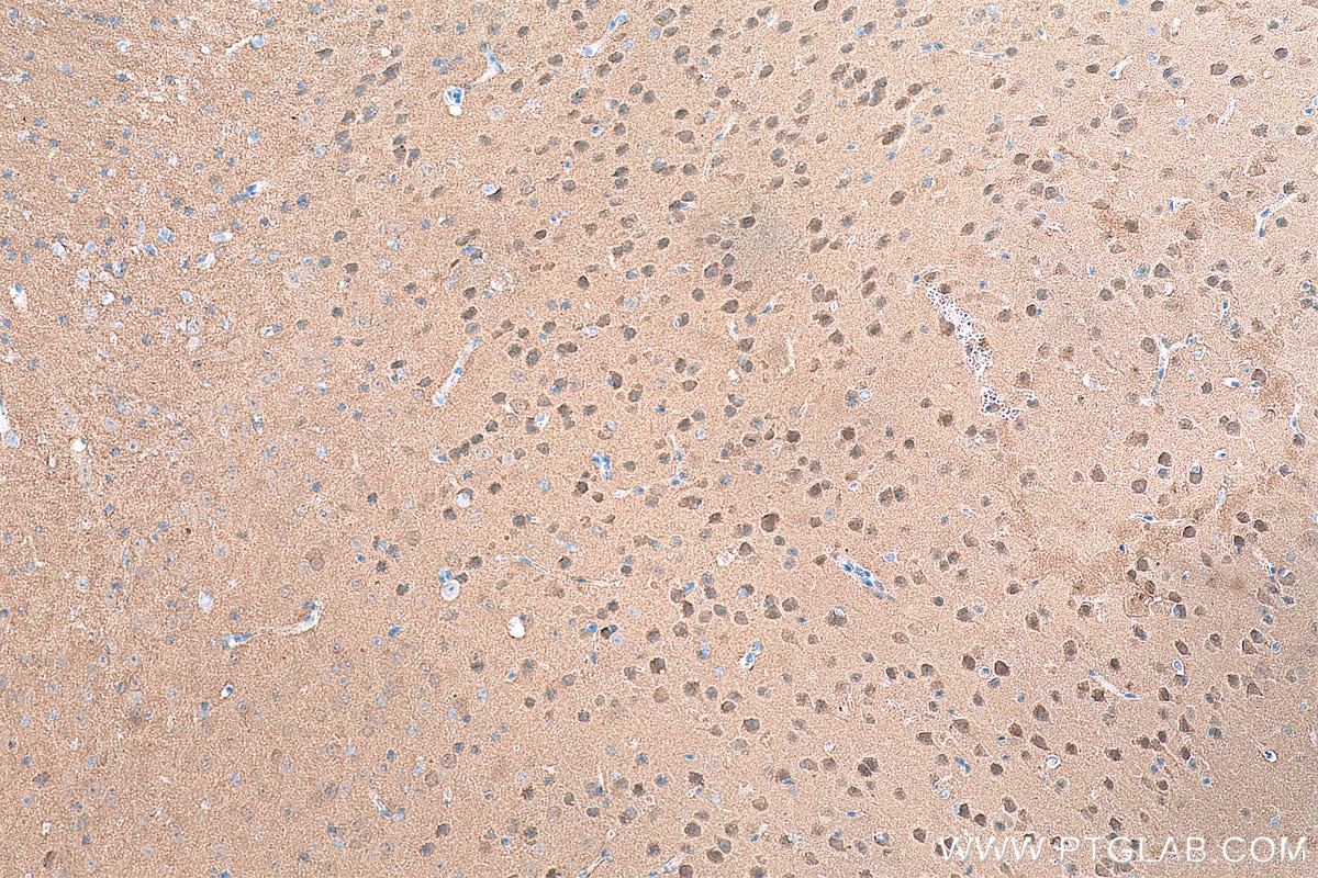 IHC staining of mouse brain using 66843-1-Ig