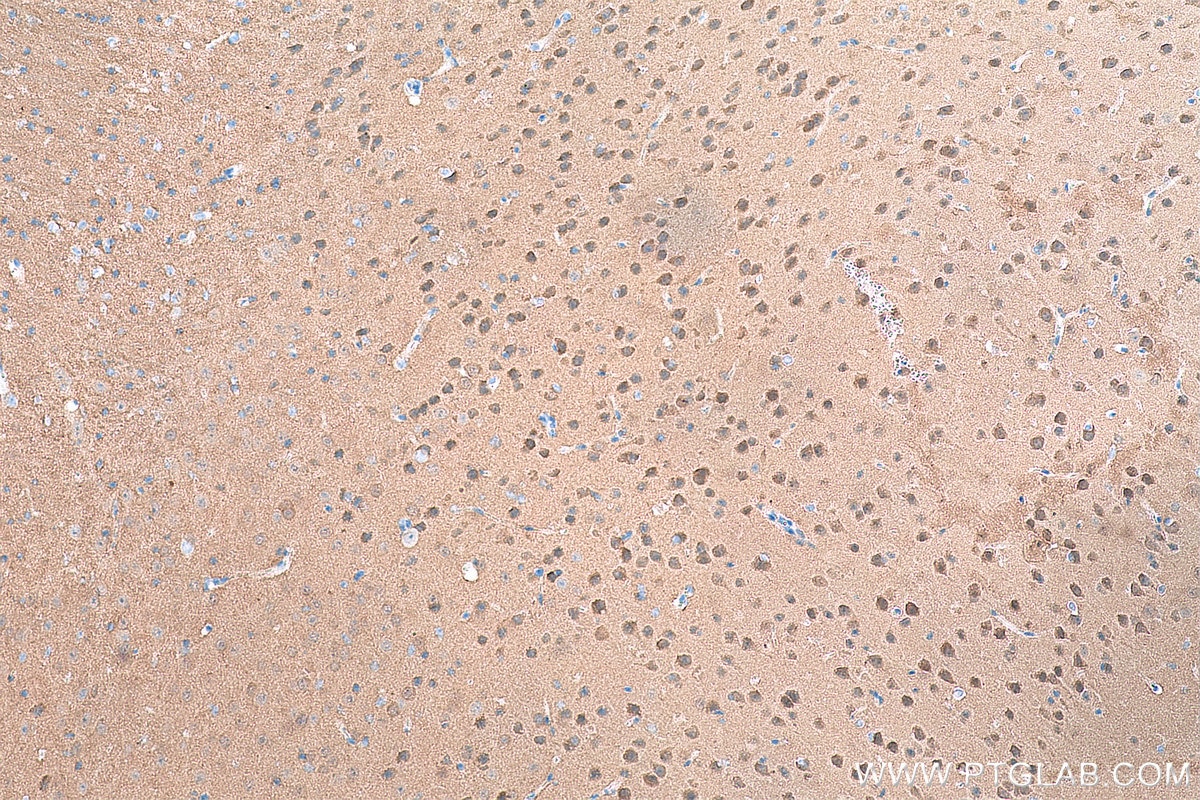 Immunohistochemistry (IHC) staining of mouse brain tissue using CaMKII alpha Monoclonal antibody (66843-1-Ig)