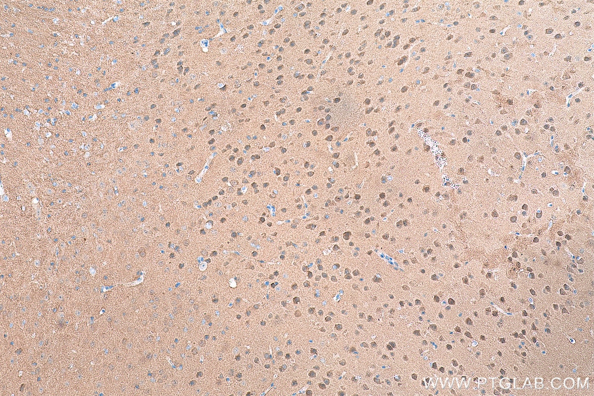 Immunohistochemistry (IHC) staining of mouse brain tissue using CAMK2 Monoclonal antibody (66843-1-Ig)