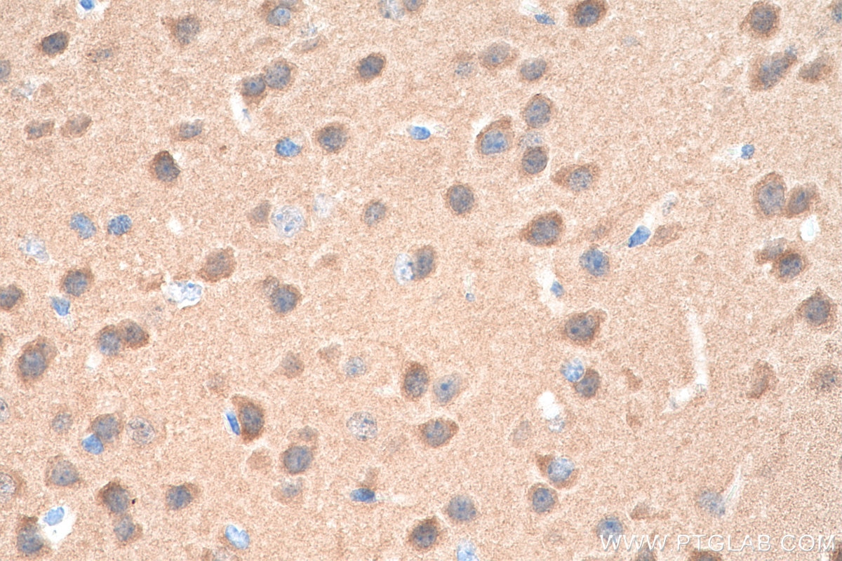 Immunohistochemistry (IHC) staining of mouse brain tissue using CAMK2 Monoclonal antibody (66843-1-Ig)