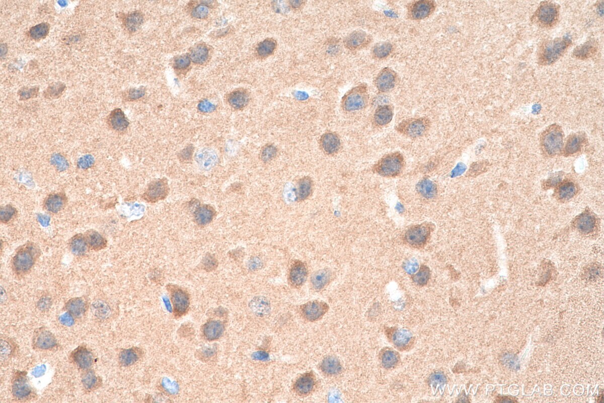 Immunohistochemistry (IHC) staining of mouse brain tissue using CaMKII alpha Monoclonal antibody (66843-1-Ig)