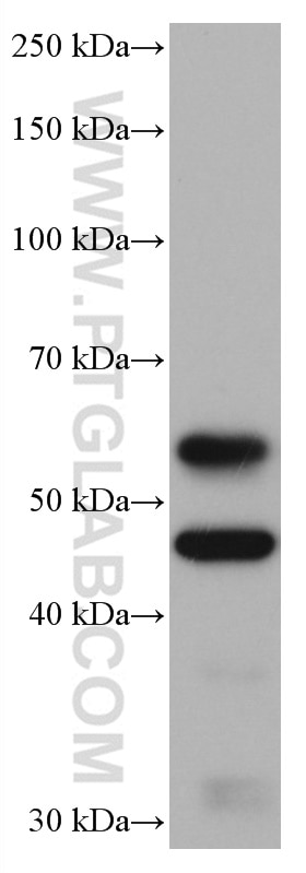 Western Blot (WB) analysis of pig brain tissue using CaMKII alpha Monoclonal antibody (66843-1-Ig)