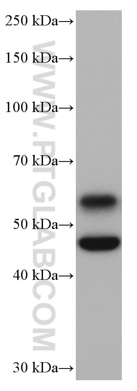 Western Blot (WB) analysis of rat brain tissue using CaMKII alpha Monoclonal antibody (66843-1-Ig)
