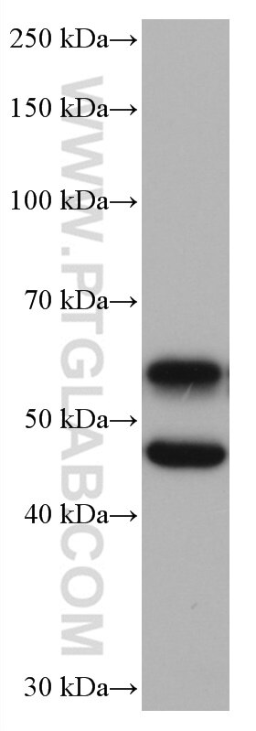 Western Blot (WB) analysis of mouse brain tissue using CaMKII alpha Monoclonal antibody (66843-1-Ig)