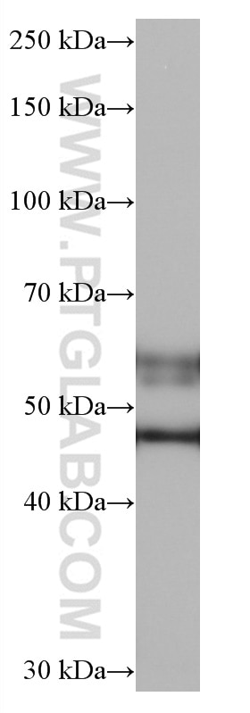 Western Blot (WB) analysis of pig cerebellum tissue using CaMKII alpha Monoclonal antibody (66843-1-Ig)